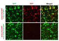 h/m ACSL4 shRNA Lentivirus – Figure 1 of 3