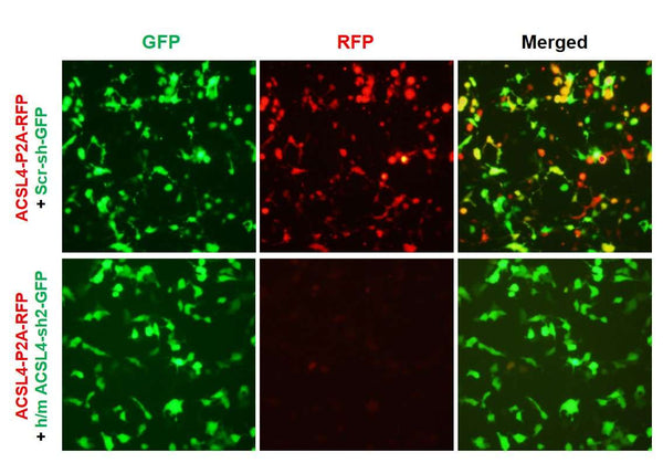h/m ACSL4 shRNA Lentivirus – Figure 1 of 3