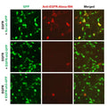 h/m EGFR shRNA Lentivirus – Figure 1 of 2