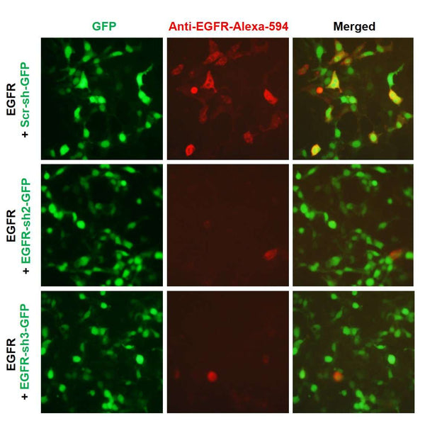 h/m EGFR shRNA Lentivirus – Figure 1 of 2