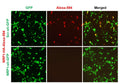 h/m NRP1 shRNA Lentivirus – Figure 1 of 2