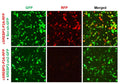 h/m SREBP2 shRNA Lentivirus – Figure 1 of 2