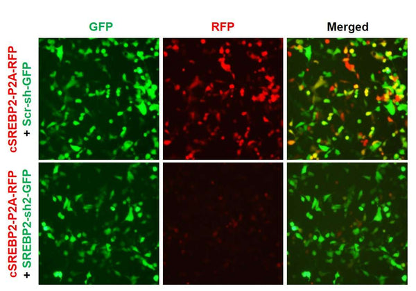 h/m SREBP2 shRNA Lentivirus – Figure 1 of 2