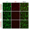 h/m KLF5 shRNA Lentivirus – Figure 1 of 2