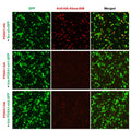 h/m FOXA1 shRNA Lentivirus – Figure 1 of 2