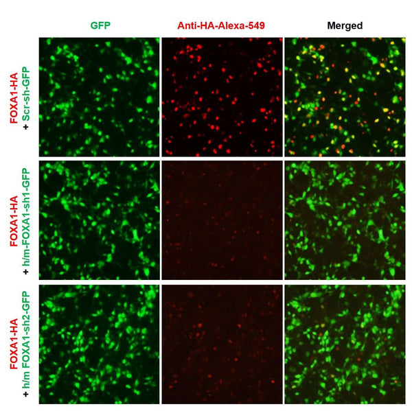 h/m FOXA1 shRNA Lentivirus – Figure 1 of 2