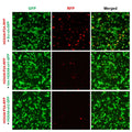 h/m HOXA9 shRNA Lentivirus – Figure 1 of 2