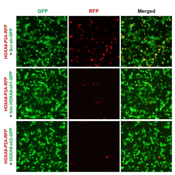 h/m HOXA9 shRNA Lentivirus – Figure 1 of 2