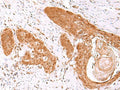 FDPS Polyclonal Antibody – Figure 1 of 3