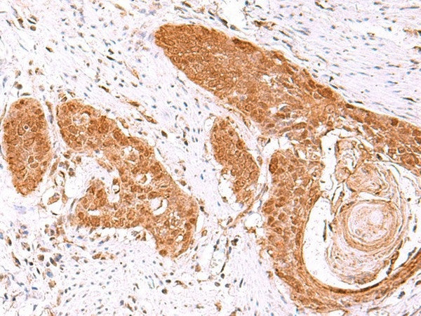FDPS Polyclonal Antibody – Figure 1 of 3