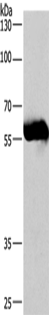 CORO1C Polyclonal Antibody – Figure 1 of 4
