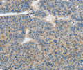 ATP4B Polyclonal Antibody – Figure 1 of 3