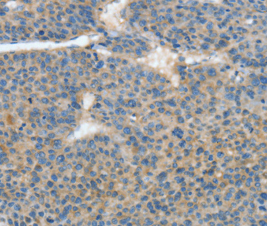 ATP4B Polyclonal Antibody – Figure 1 of 3
