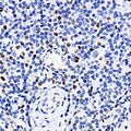 ERK 2 Polyclonal Antibody – Figure 1 of 5