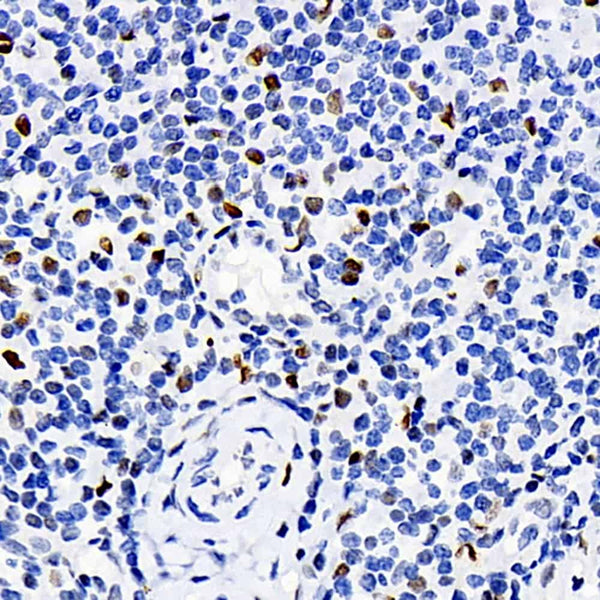 ERK 2 Polyclonal Antibody – Figure 1 of 5