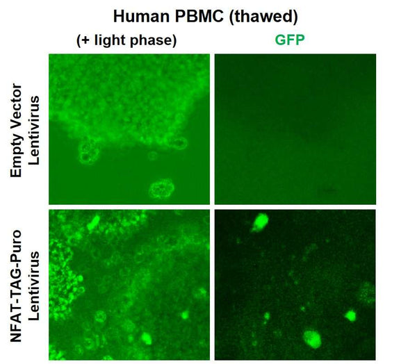 NFAT Reporter Lentivirus – Figure 1 of 9