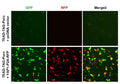 TEAD Reporter Lentivirus – Figure 1 of 10