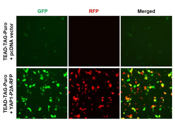 TEAD Reporter Lentivirus – Figure 1 of 10