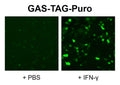 GAS Reporter Lentivirus – Figure 1 of 4