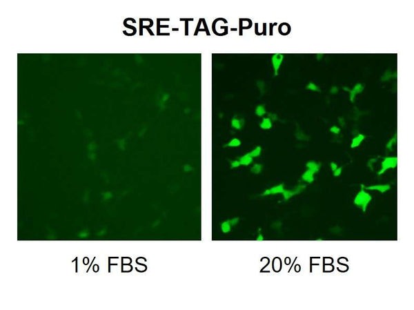 SRE Reporter Lentivirus – Figure 1 of 5