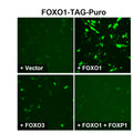 FOXO1/IRE Reporter Lentivirus – Figure 1 of 4