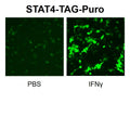 STAT4 Reporter Lentivirus – Figure 1 of 5