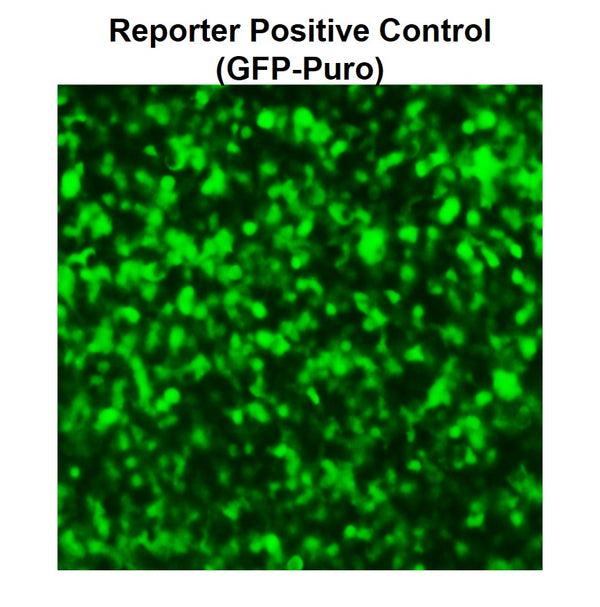 Reporter Positive Control Lentivirus – Figure 1 of 2