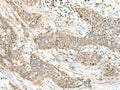 LIG4 Polyclonal Antibody – Figure 1 of 2