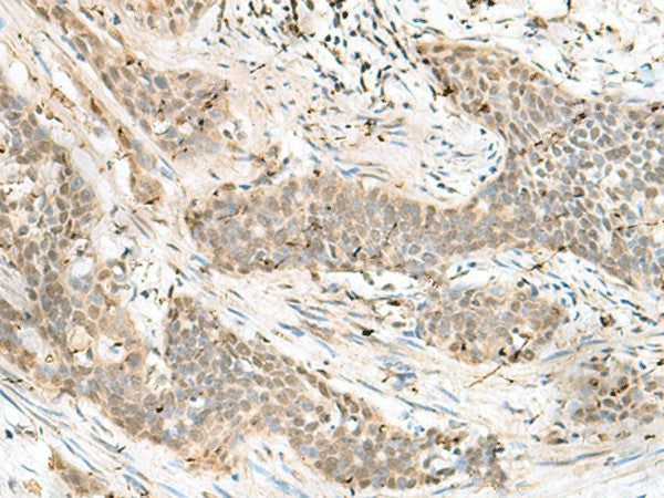 LIG4 Polyclonal Antibody – Figure 1 of 2