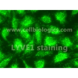 GFP-Expressing Monkey Primary Lymphatic Endothelial Cells product image