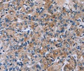 HSD3B2 Polyclonal Antibody – Figure 1 of 2