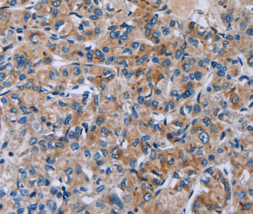 HSD3B2 Polyclonal Antibody – Figure 1 of 2