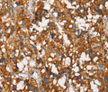 SNCA Polyclonal Antibody – Figure 1 of 3
