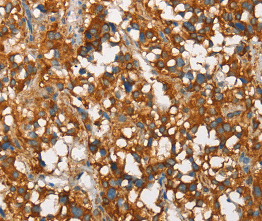 SNCA Polyclonal Antibody – Figure 1 of 3