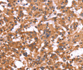 CRISP3 Polyclonal Antibody – Figure 1 of 3