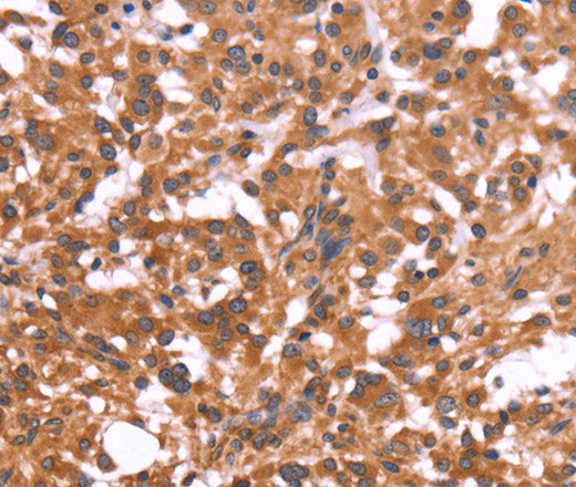 CRISP3 Polyclonal Antibody – Figure 1 of 3