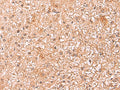 ASTN2 Polyclonal Antibody – Figure 1 of 3
