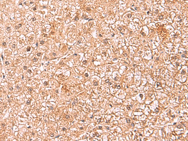 ASTN2 Polyclonal Antibody – Figure 1 of 3