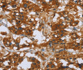 COMP Polyclonal Antibody – Figure 1 of 3