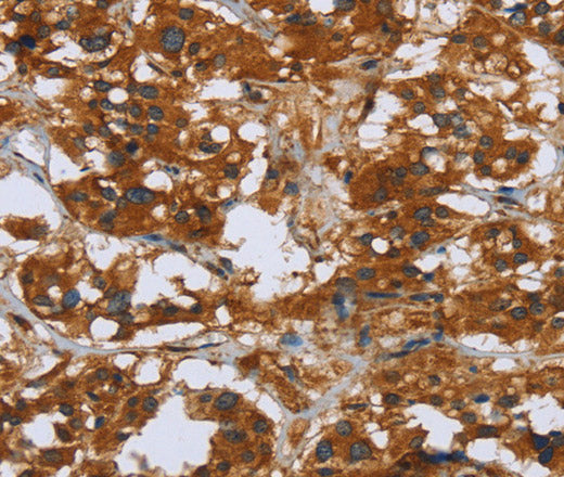 COMP Polyclonal Antibody – Figure 1 of 3