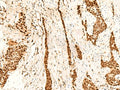 METTL1 Polyclonal Antibody – Figure 1 of 2