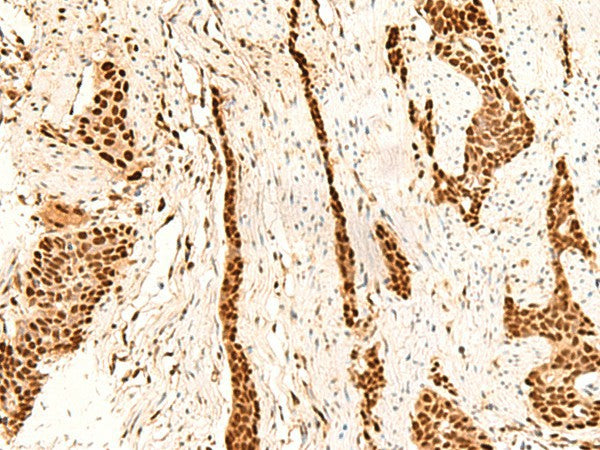 METTL1 Polyclonal Antibody – Figure 1 of 2
