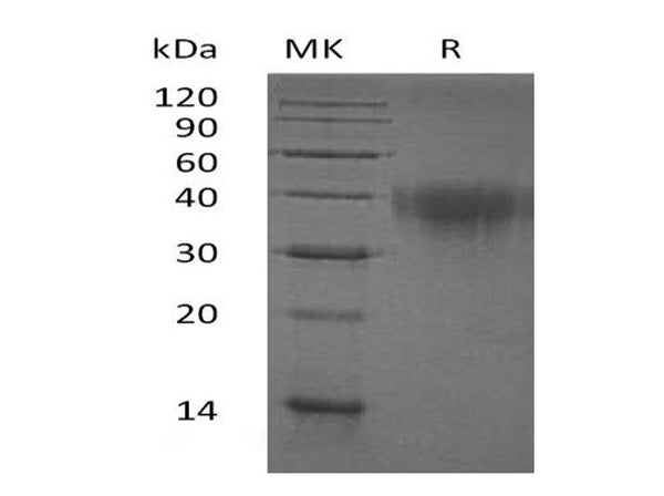 Recombinant Human PD-1/PDCD1 Protein (His Tag) – Figure 1 of 2