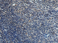 HAUS6 Polyclonal Antibody – Figure 1 of 2