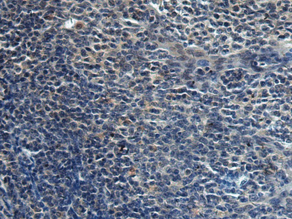 HAUS6 Polyclonal Antibody – Figure 1 of 2