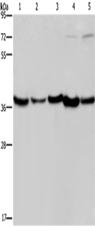 DNAJB4 Polyclonal Antibody – Figure 1 of 4