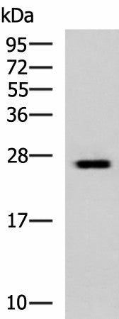 GINS3 Polyclonal Antibody – Figure 1 of 3