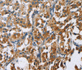 CARD9 Polyclonal Antibody – Figure 1 of 3
