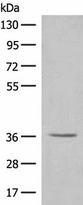 LGALS4 Polyclonal Antibody – Figure 1 of 4