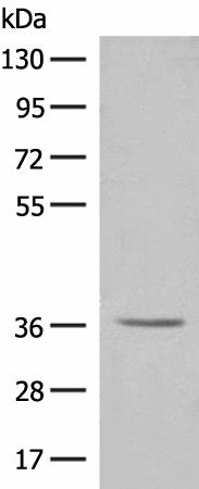 LGALS4 Polyclonal Antibody – Figure 1 of 4